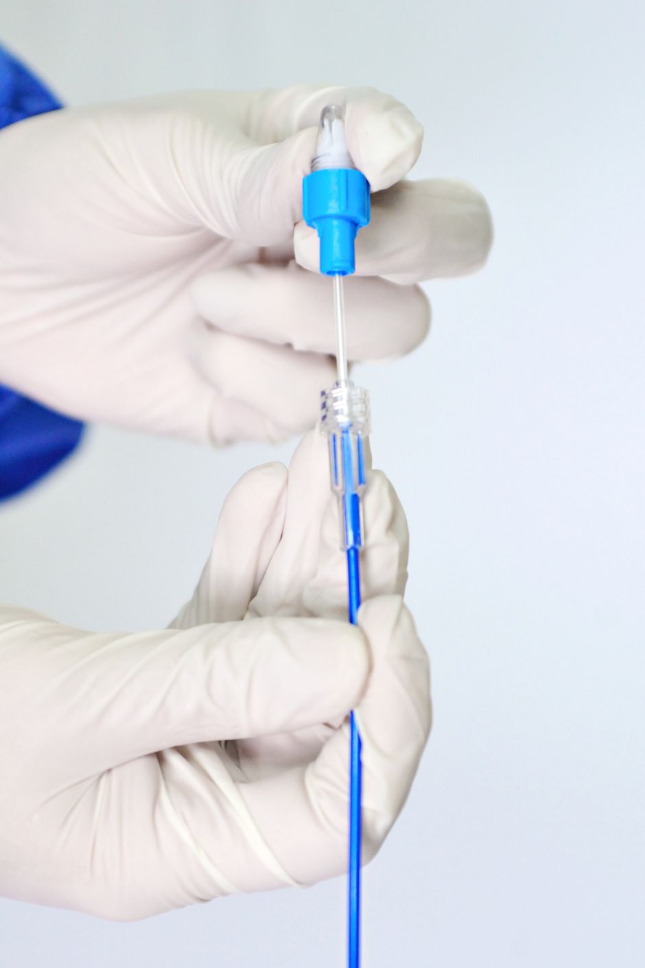 Endoprótesis Aórtica Modular AortiSeal